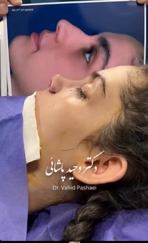 عمل بینی ترمیمی